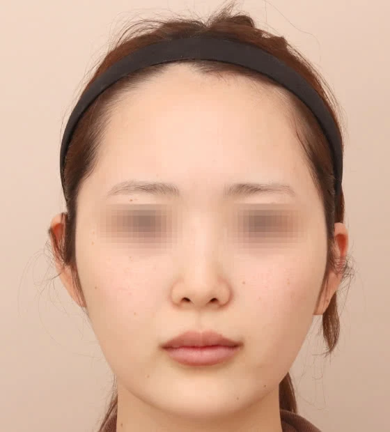 Before
