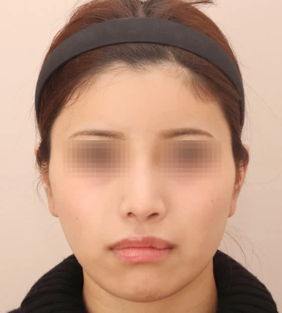 After