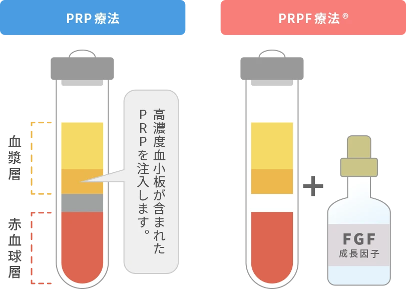 PRPF薬剤