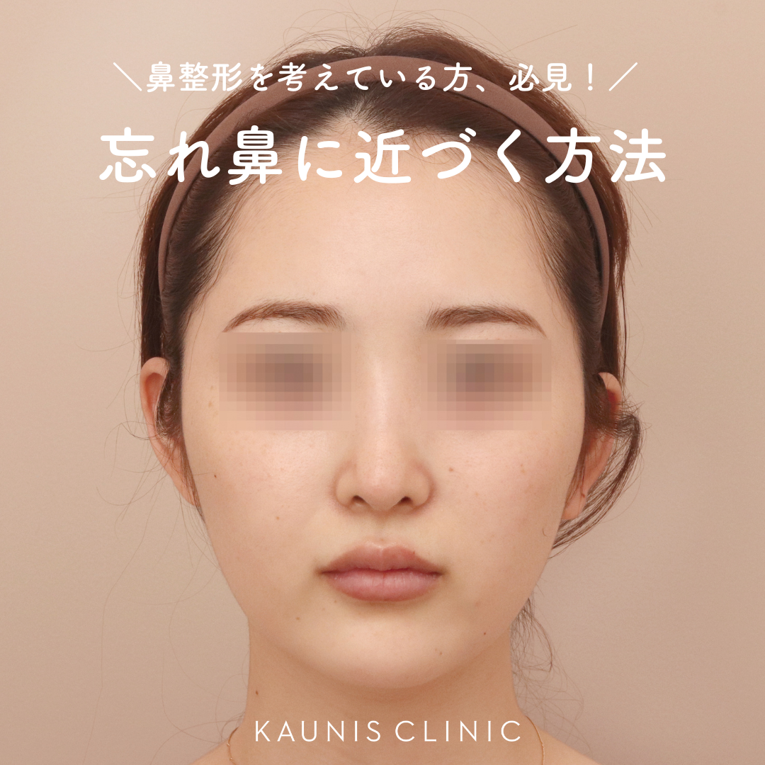 忘れ鼻に近づく方法 | オフィシャルブログ | 表参道・青山の美容整形「KAUNIS CLINIC カウニスクリニック」