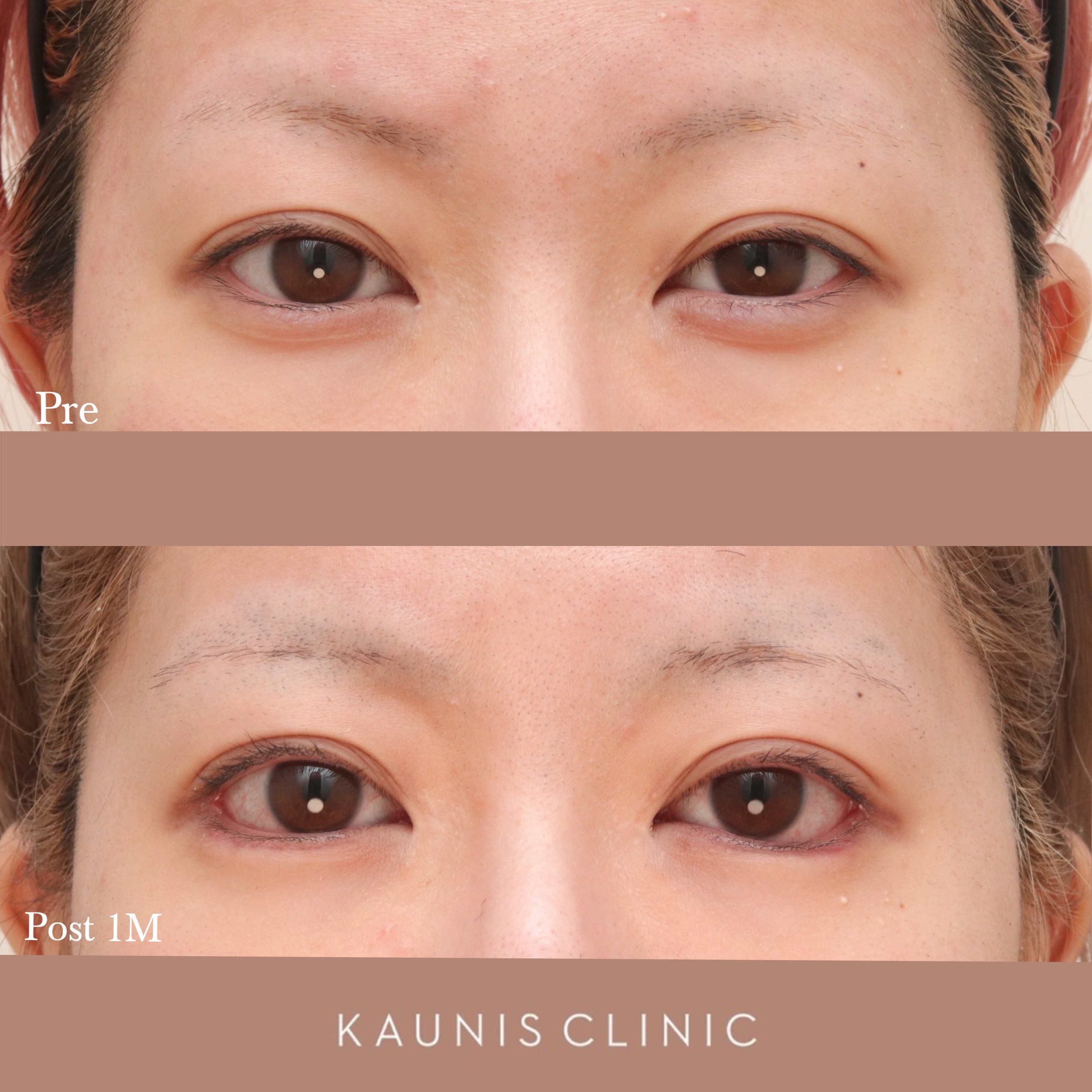 (裁断済み)眼科プラクティス24 見た目が大事！眼腫瘍 裁断済み)眼科プラクティス24 見た目が大事眼腫瘍 眼科受診の